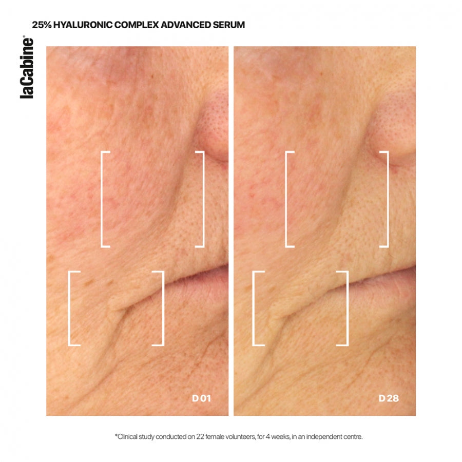ლა კაბინი-ს სახის კანის შრატი Advanced სერიიდან 25%-იანი ჰიალურონის მჟავით